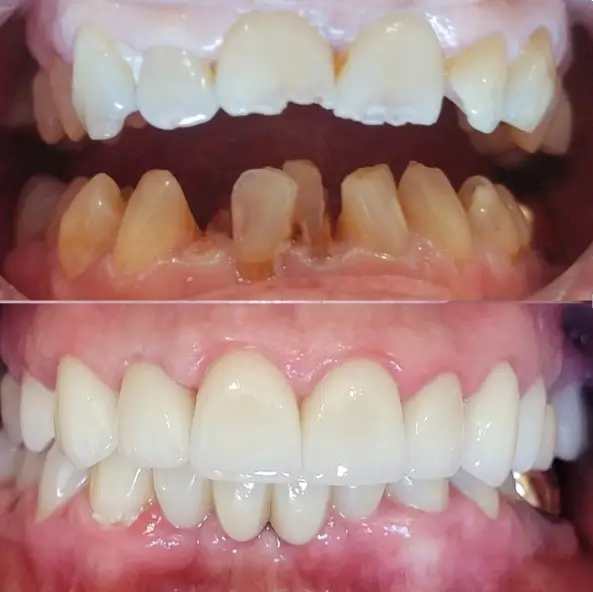 before and after dentist transformation