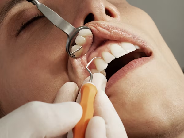 image showing how a dental exam is performed